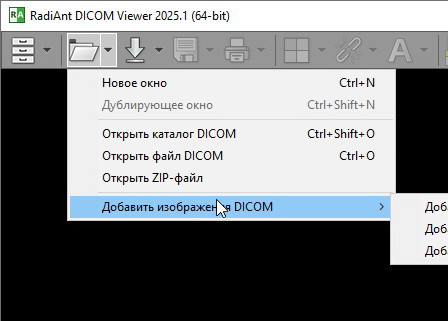RadiAnt DICOM Viewer 2025.1 + ключ (активация)