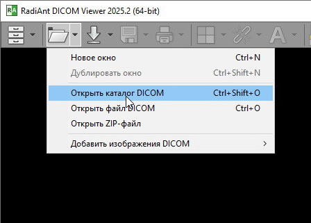 RadiAnt DICOM Viewer 2025.2 + ключ (активация)